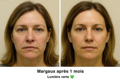 Masque LED Visage 4 Couleurs, Soin Beauté Maison